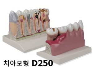 [독일Zimmer] 4배확대 치아모형 D250 / Dental model, 4 times life size/YS