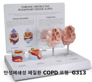[GPI] 만성 폐쇄성 폐질환모형 COPD G313