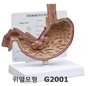 [GPI] 위암모형 G2001 실제사이즈의 반쪽