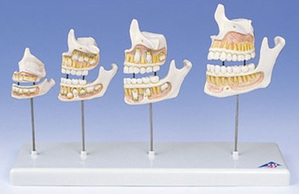 [3B] 치아발달모형 4단계  D20 (Dentition Development)