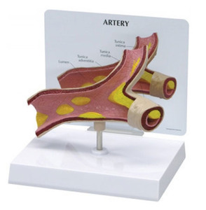 [GPI] 동맥경화모형 G260 (Artery Model 260)