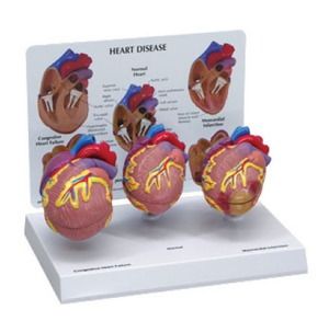 [GPI] 심장질환 모형 G255 (3-Pcs,Mini Heart Set Models 255) 심장모형