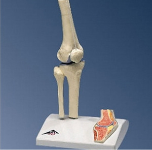 [3B] 미니 무릎모형 A85/1 (Mini Knee Joint with Cross Section)