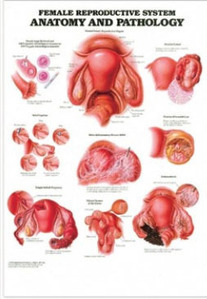 3D해부도(벽걸이)/9869M/여성생식기 해부학 및 병리학 차트,산부인과차트/Female Reproductive System/ Size 47cmⅹ65cm