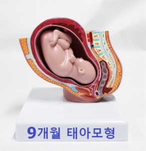 [HEC] 성숙아 와 임신골반 kim3-4005 (110*110*H150mm)