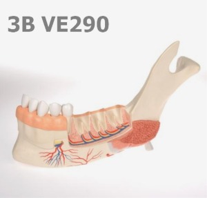 [3B Scientific] 8종류  치아질환이 있는19분리 하악모형 VE290 (22*32*9cm,0.9Kg) Advanced Half Lower Jaw with 8 diseased teeth, 19 part