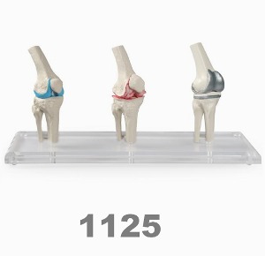 [독일Zimmer] 무릎관절 모형 1125 (임플란트,3단계) Knee-Implant-Model/MI
