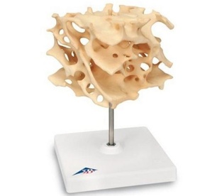 [3B] 해면모양의 뼈모형 A99  (Cancellous Bone) 해면골모형