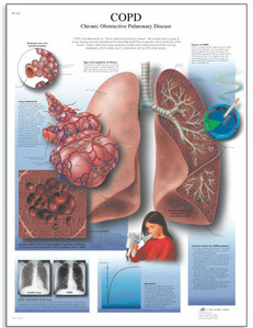 [3B] 폐질환차트,COPD차트/VR1329UU(비코팅)/Chronic Obstructive Pulmonary Disease/ Size 50x67cm
