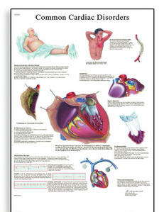 [3B] 심장질환차트/VR1343UU(비코팅)/Common Cardiac Disorders Chart/ Size 50x67cm