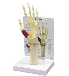 [GPI] 손목터널증후군 모형 G192 (Hand Wrist 192- Carpal Tunnel Syndrome)