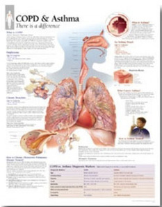 평면해부도(벽걸이)/1355/만성폐쇄성폐질환,천식차트/COPD &amp; Asthma/ Size 54cmⅹ74cm