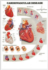 3D해부도(벽걸이)/9915/심혈관차트,심혈관질환차트/Cardiovascular Disease/ Size 54cmⅹ74cm