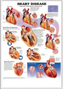 3D해부도(벽걸이)/9912/심장질병차트,심장병차트/Heart Disease/ Size 54cmx74cm