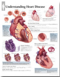 평면해부도(벽걸이)/1454/심장질환의 이해/Understanding Heart Disease/ Size 54cmⅹ74cm