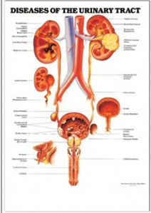 3D해부도(벽걸이)/9797/배뇨기질병,배뇨질환,신장차트/Diseases of The Urinary Tract/ Size 54cmx74cm