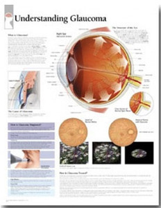 평면해부도(벽걸이)/2250 /녹내장 차트/Understanding Glaucoma / Size 54cmⅹ74cm